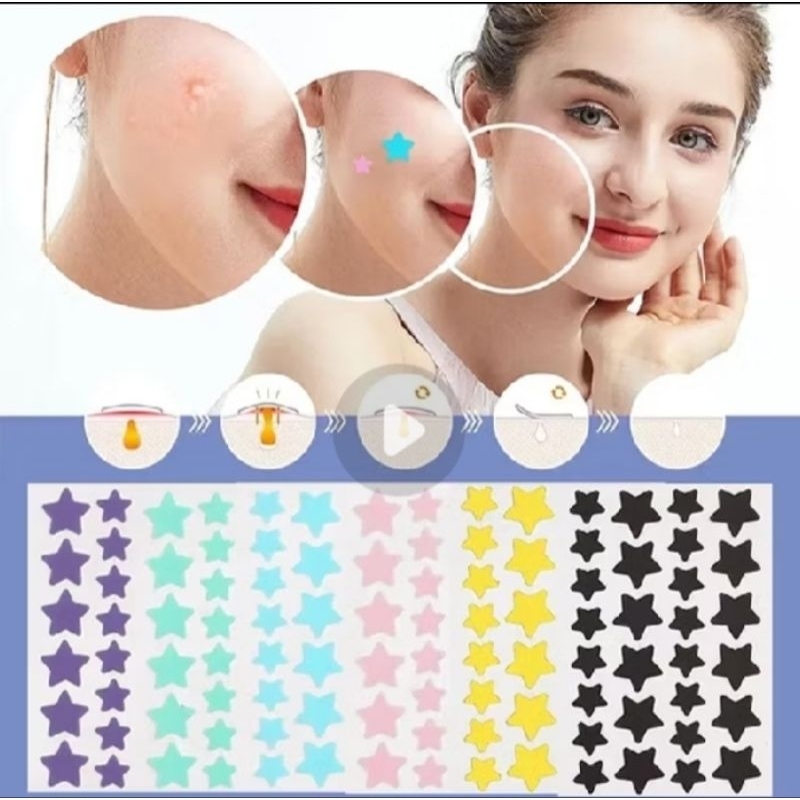( RANDOM) ACNE PATCH JERAWAT WARNA WARNI BINTANG