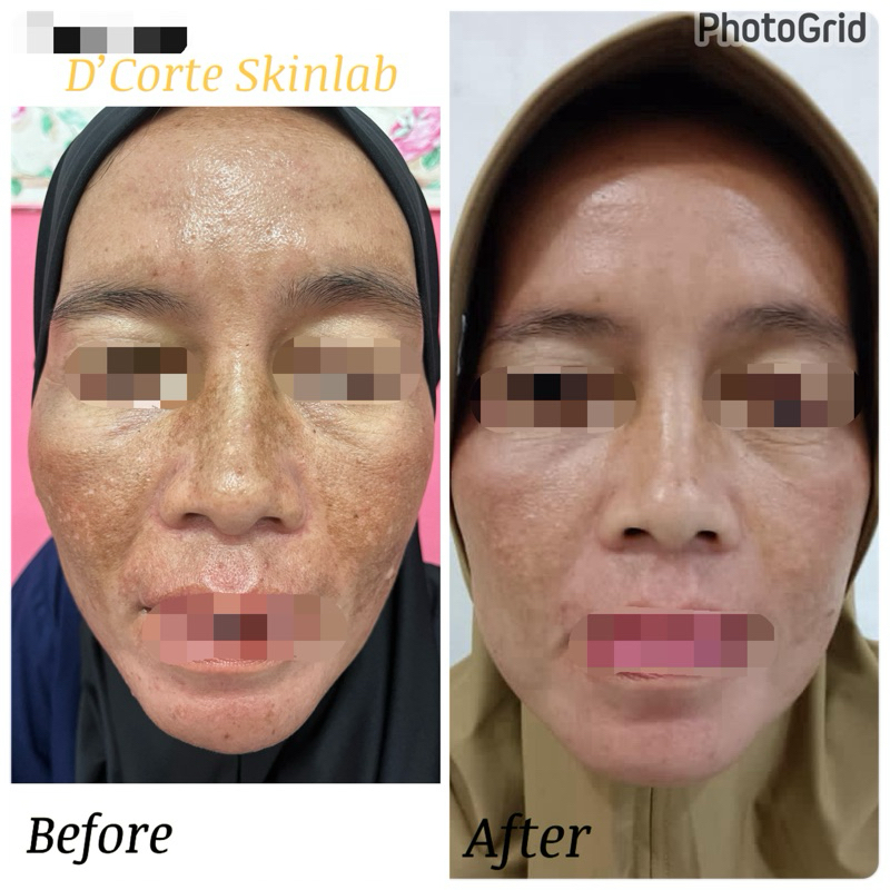 D’Corte Skinlab