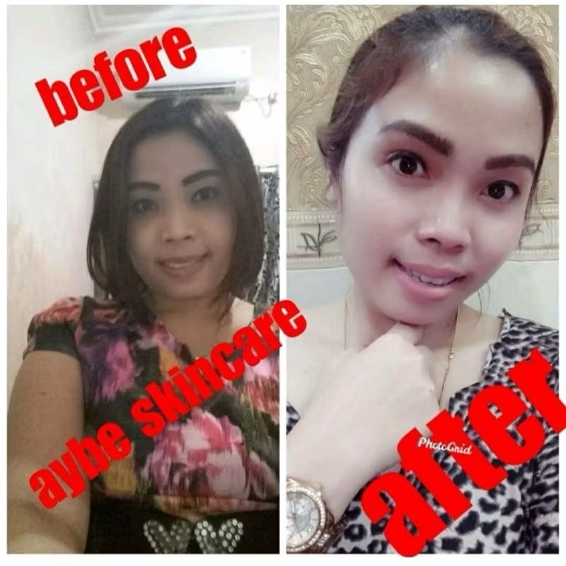 Eye Cream aybe/Cream mata aybe