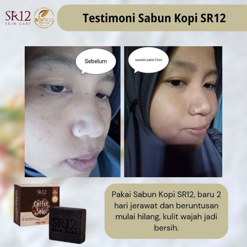 soap batang sr12
