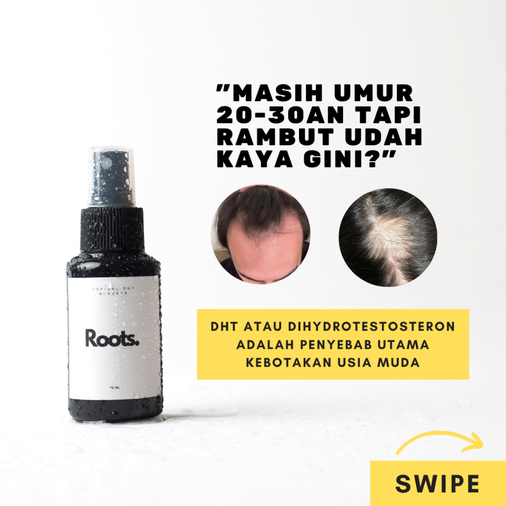 Serum DHT Blocker Rambut Rontok ROOTS 70 ML