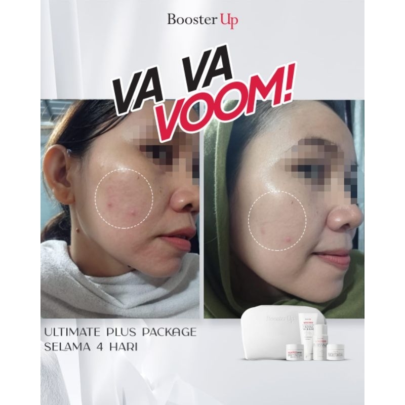 paket booster up