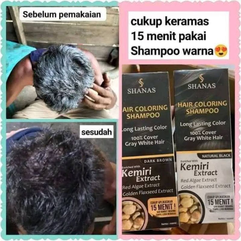 shampo uban nasa