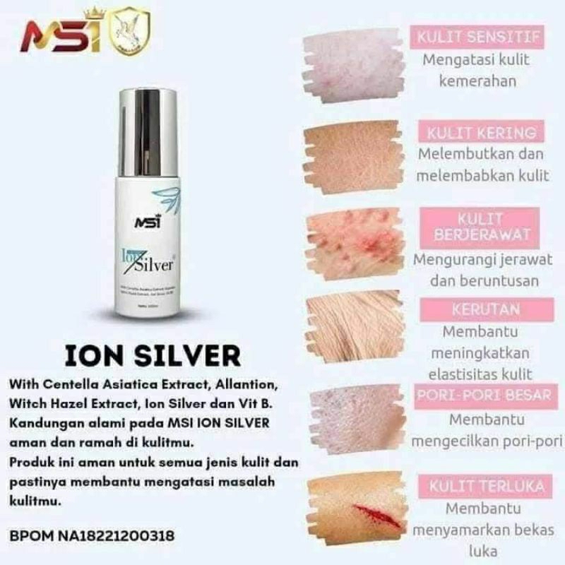 ionsilvermsi
