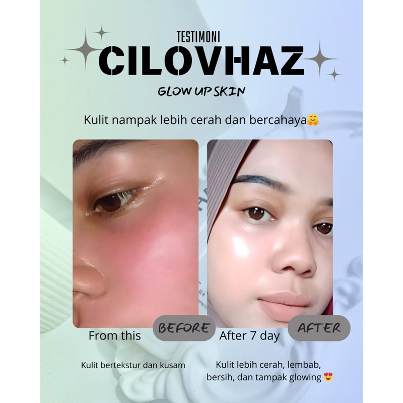 CILOVHAZ BPOM