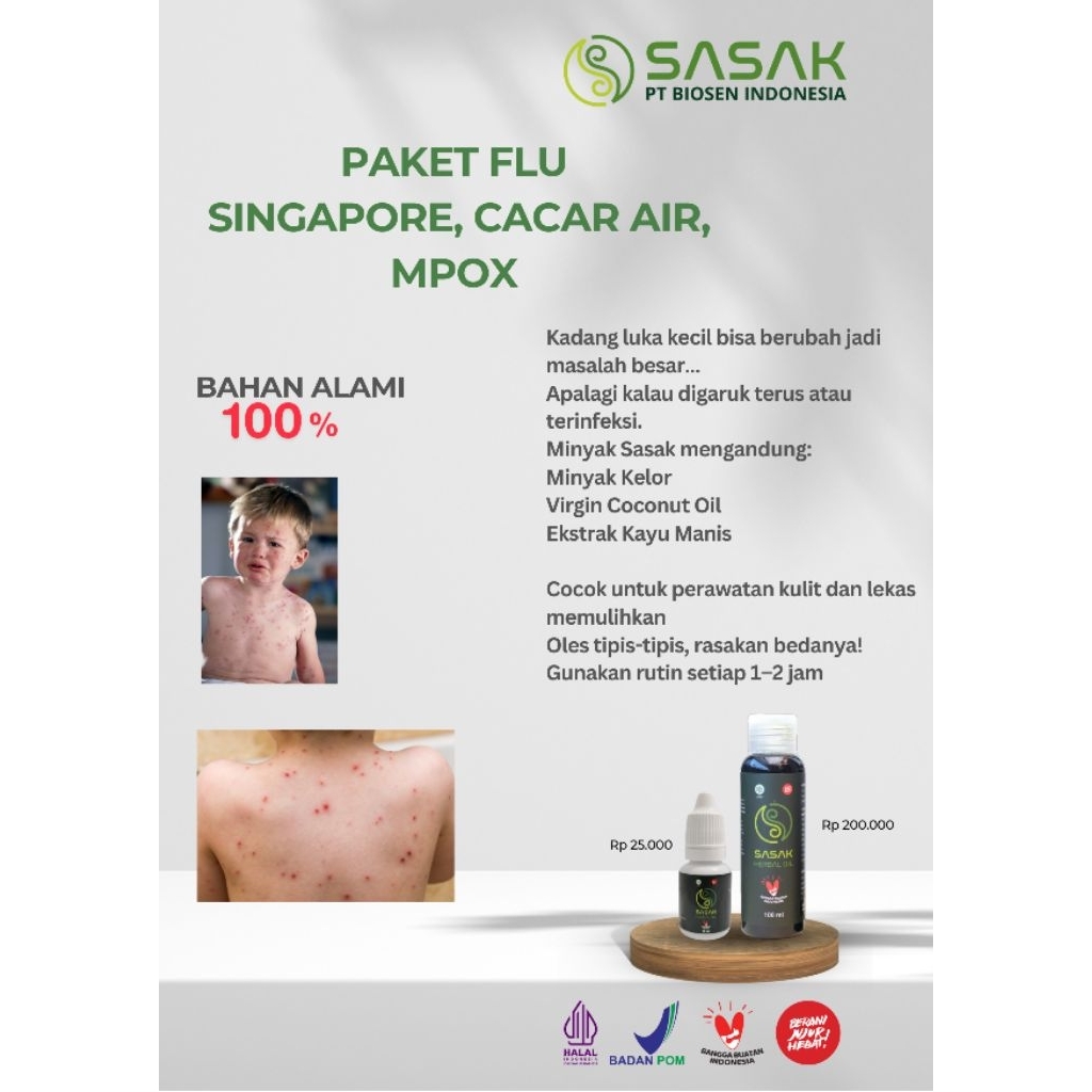 PAKET MPOX, FLU SINGA, CACAR AIR