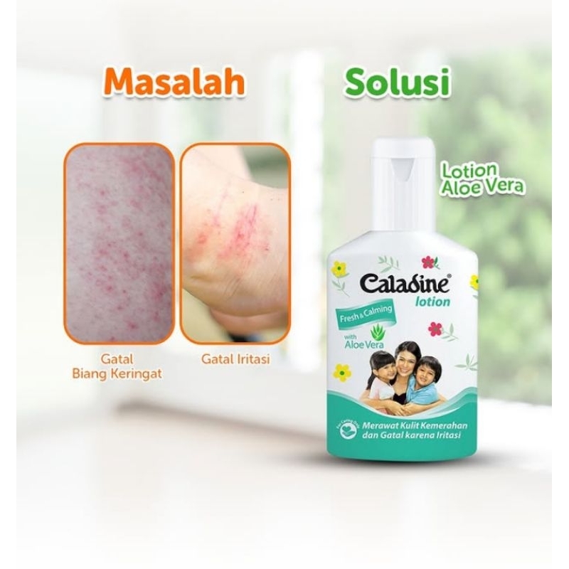 CALADINE LOTION FRESH CALMING