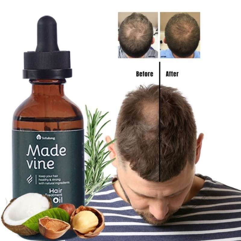 oil serum pria
