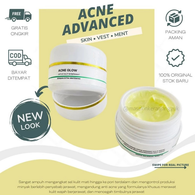 krim malam acne glow