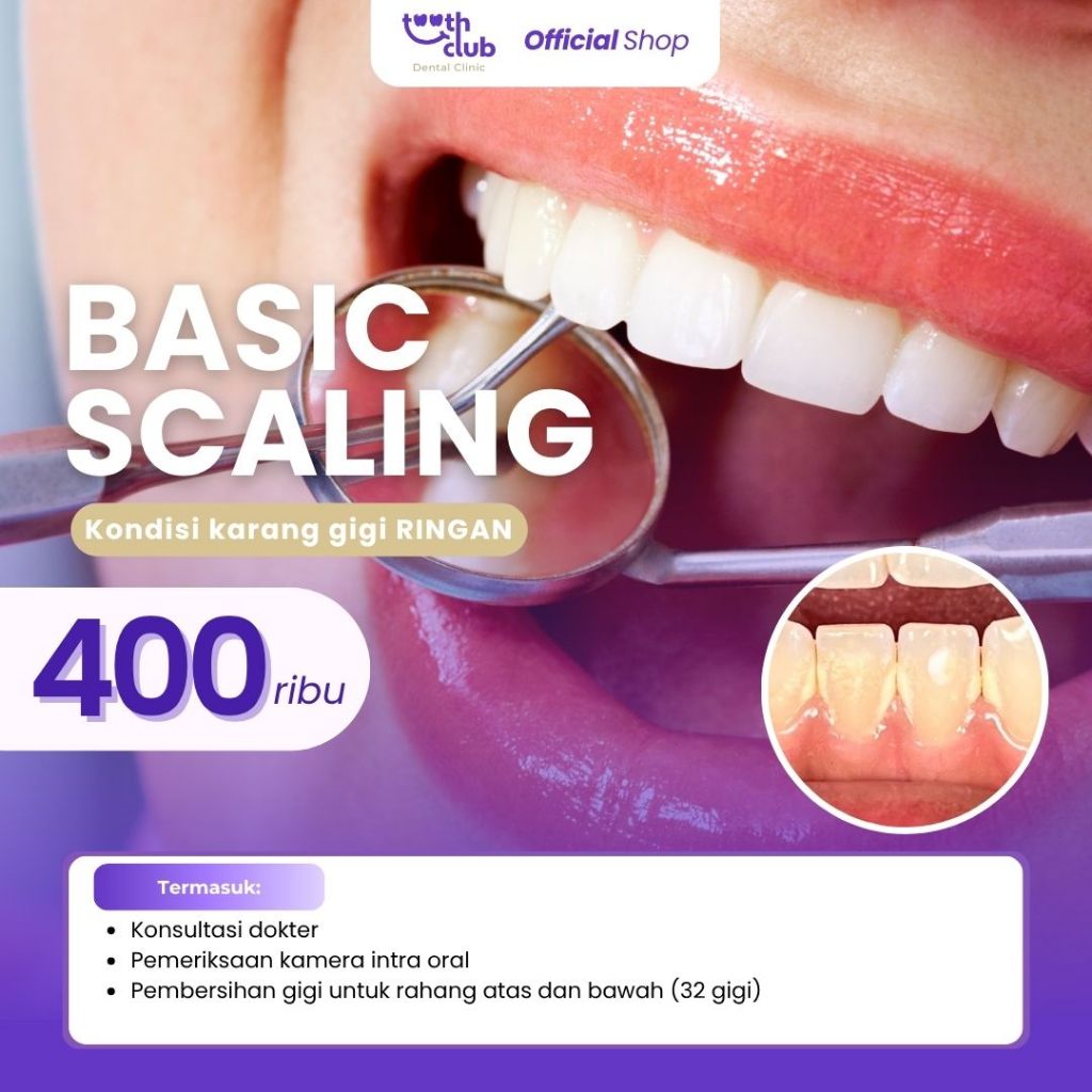 Basic Scaling / Pembersihan Karang Gigi Basic