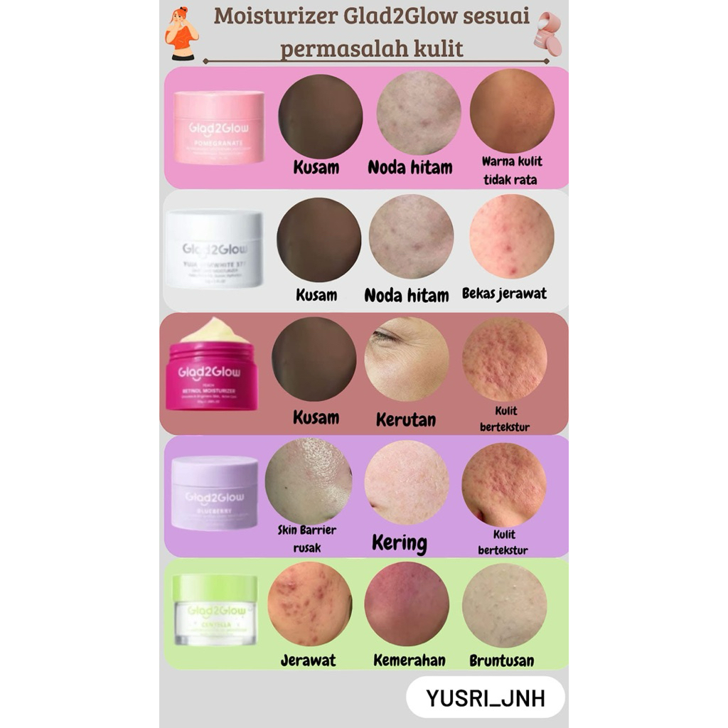 MOISTURIZER GLAD2GLOW ALL VARIAN