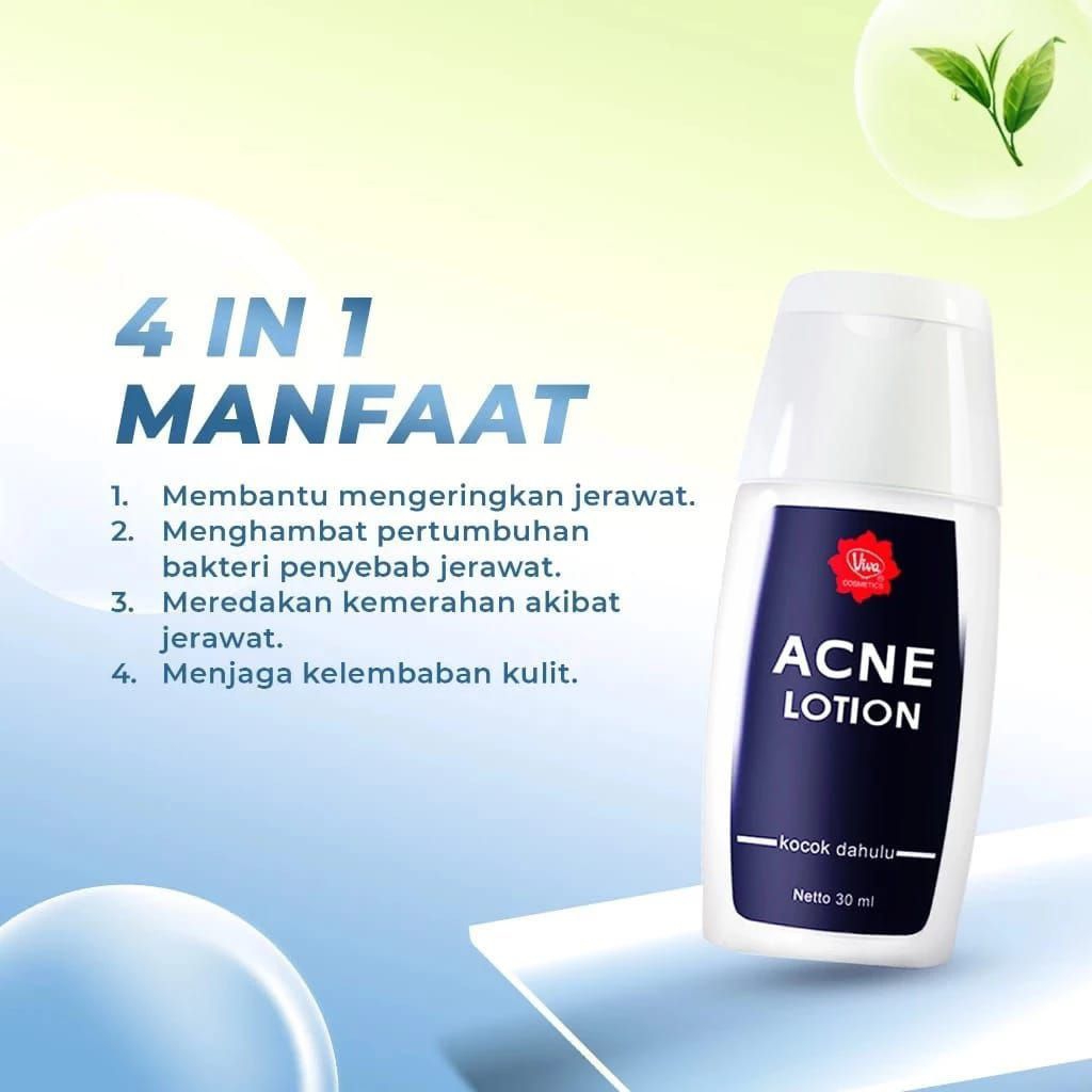 Viva Acne Lotion