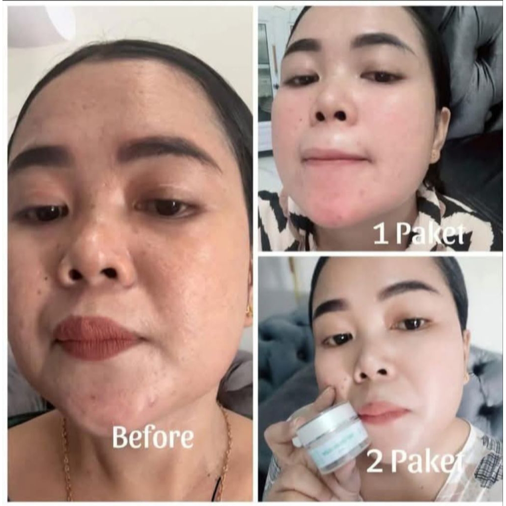 paket ASTRIDglow /flek ORI