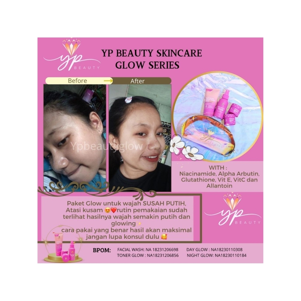 Ypbeauty
