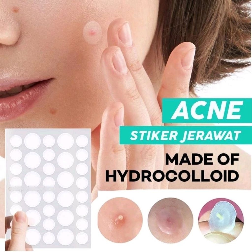 STIKER JERAWAT / ACNE PATCH