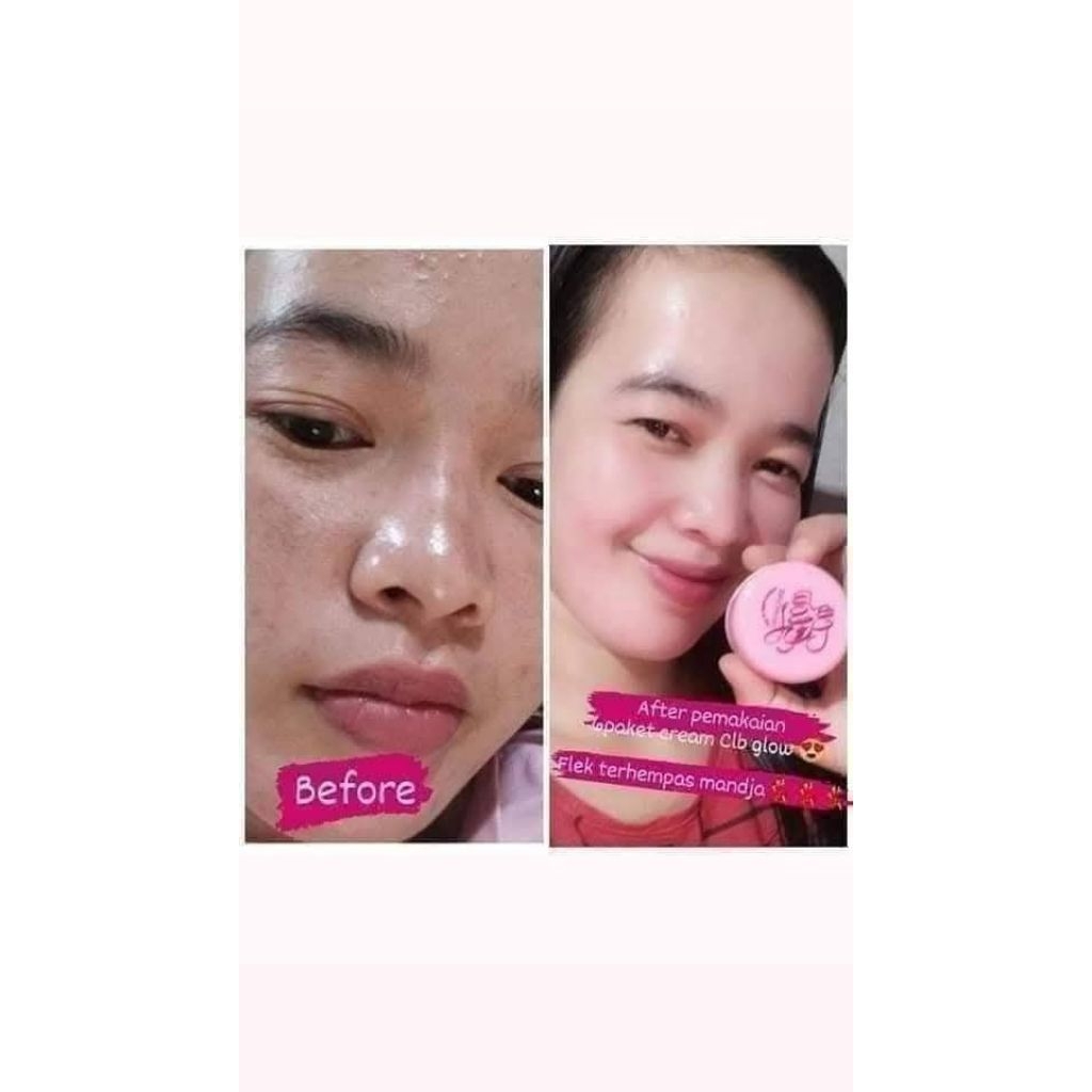 CREAM C.EL.B GLOW ECER