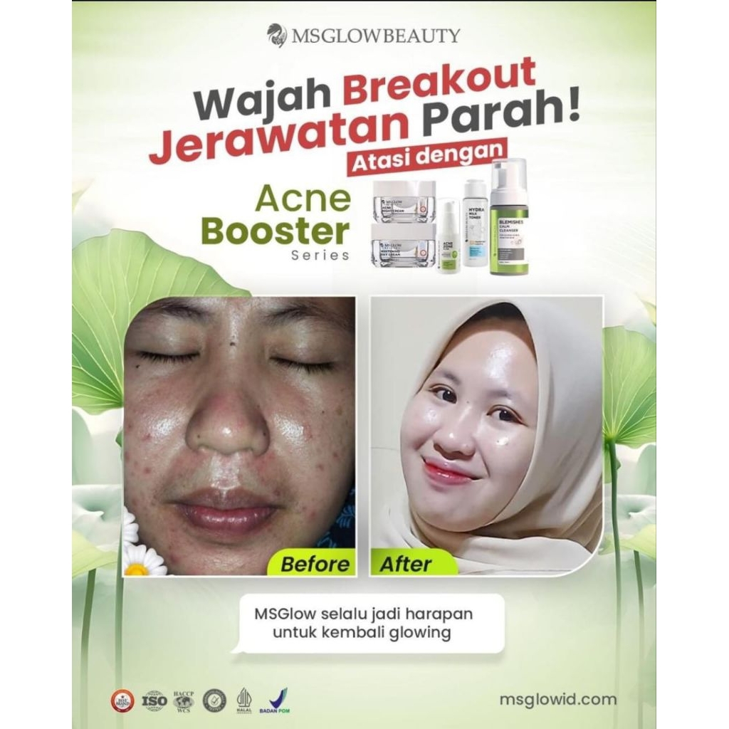PAKETAN MS GLOW BOOSTER