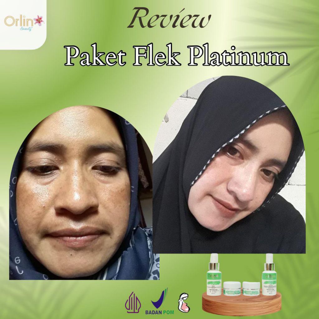 paket Flek Platinum