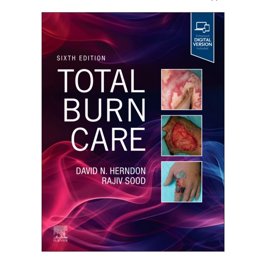Total Burn Care