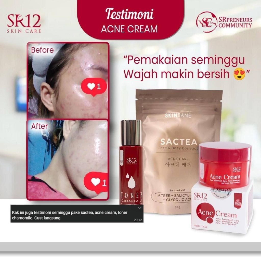 acne cream sr12