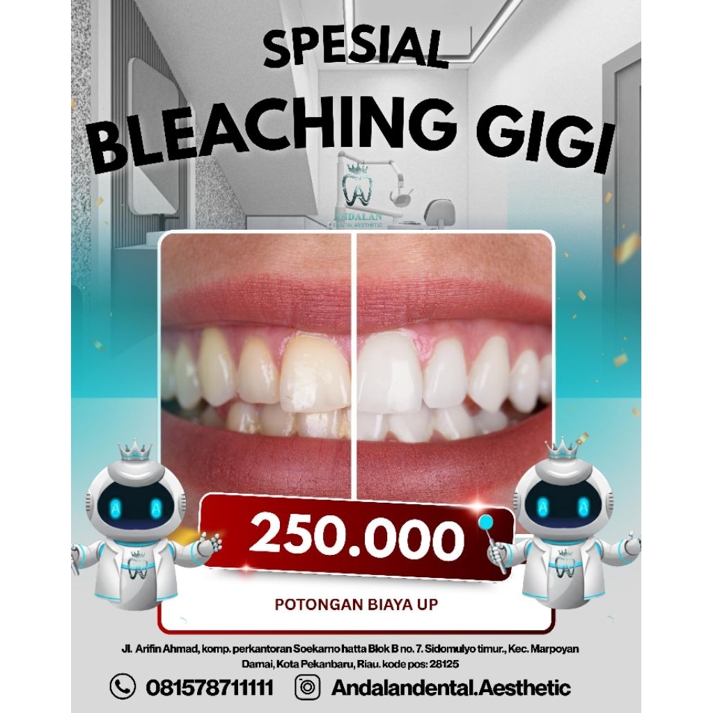 Bleaching Gigi