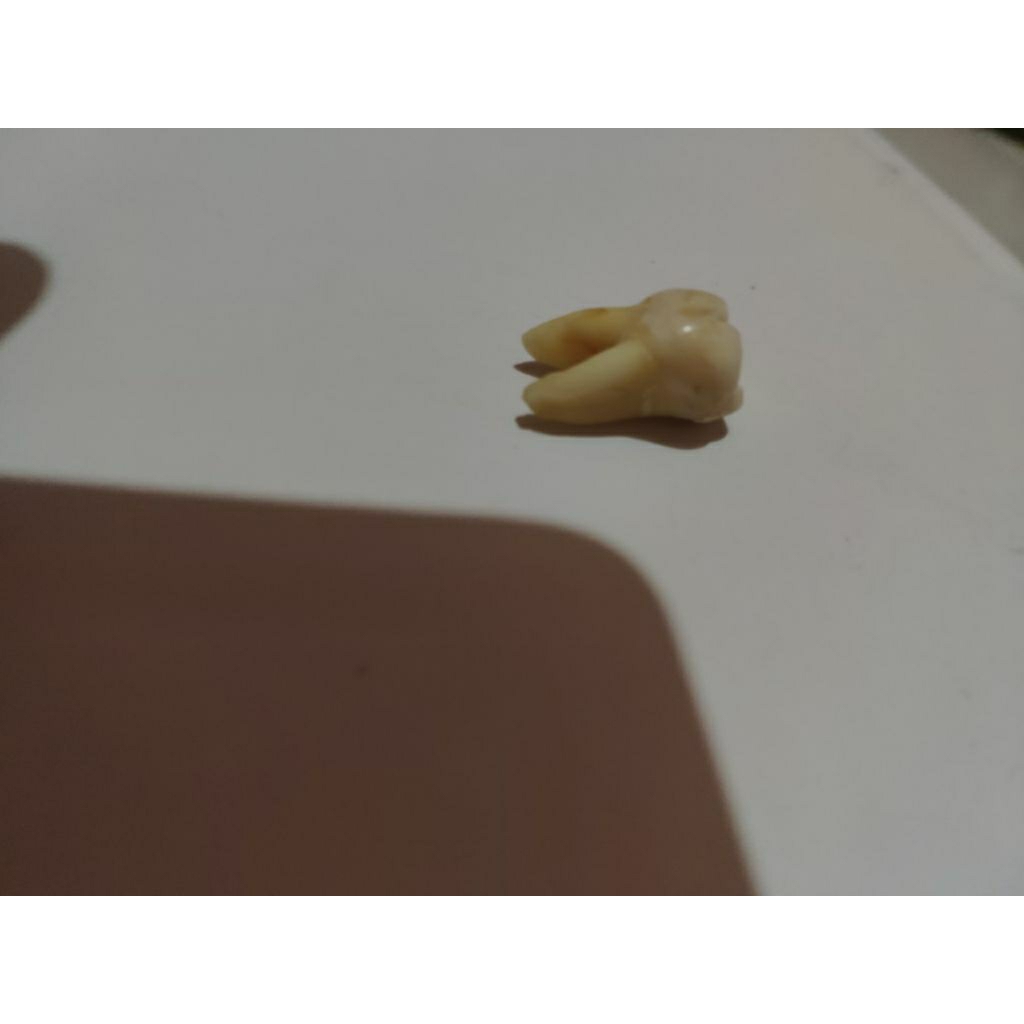 Gigi Molar Ar/38
