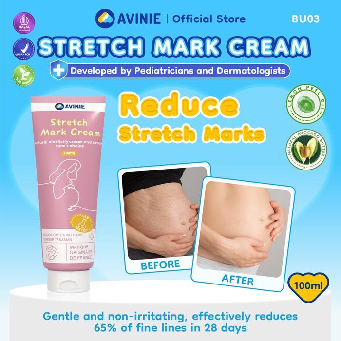 Avinie Stretch Mark Cream 100ml BU03
