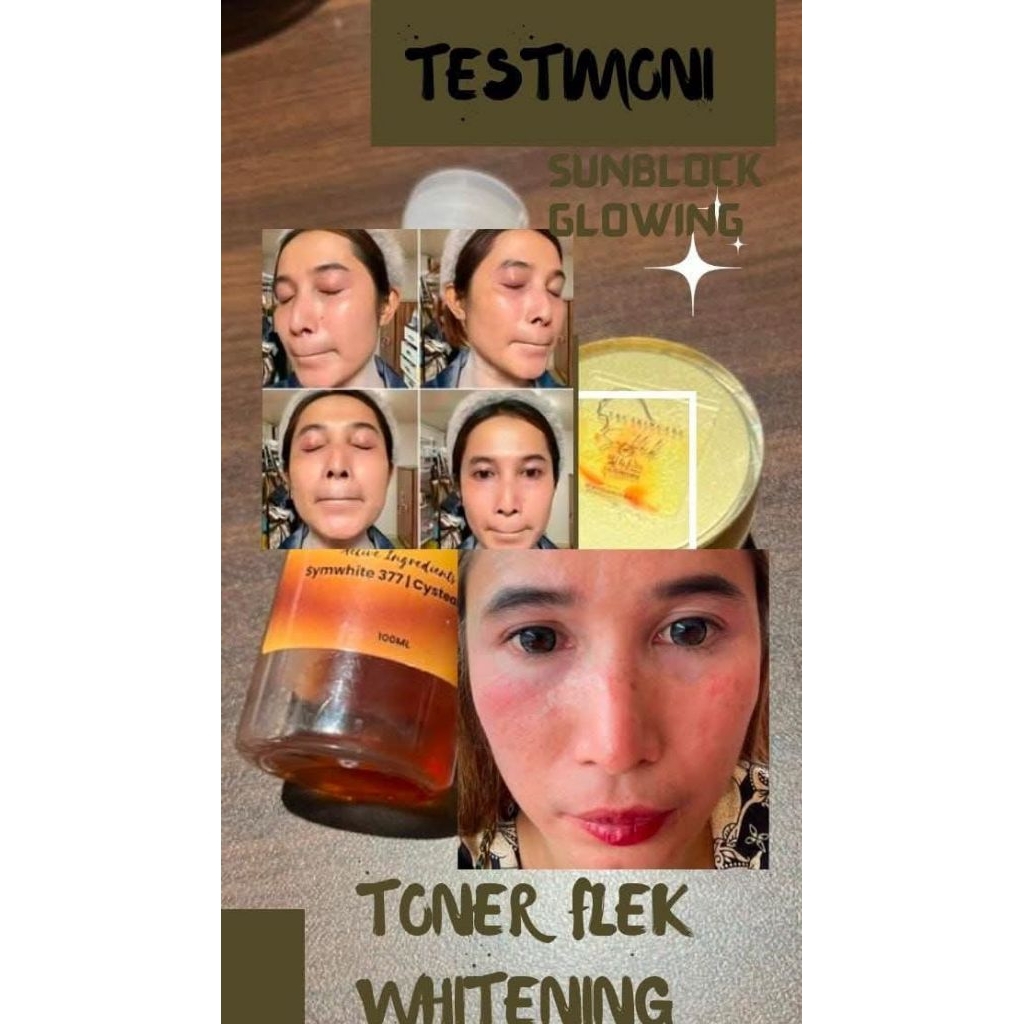 toner flek &whitening