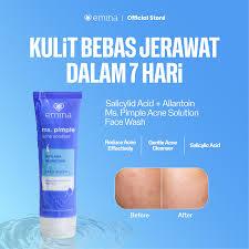 Emina Face Wash ms. Pimple acne solution