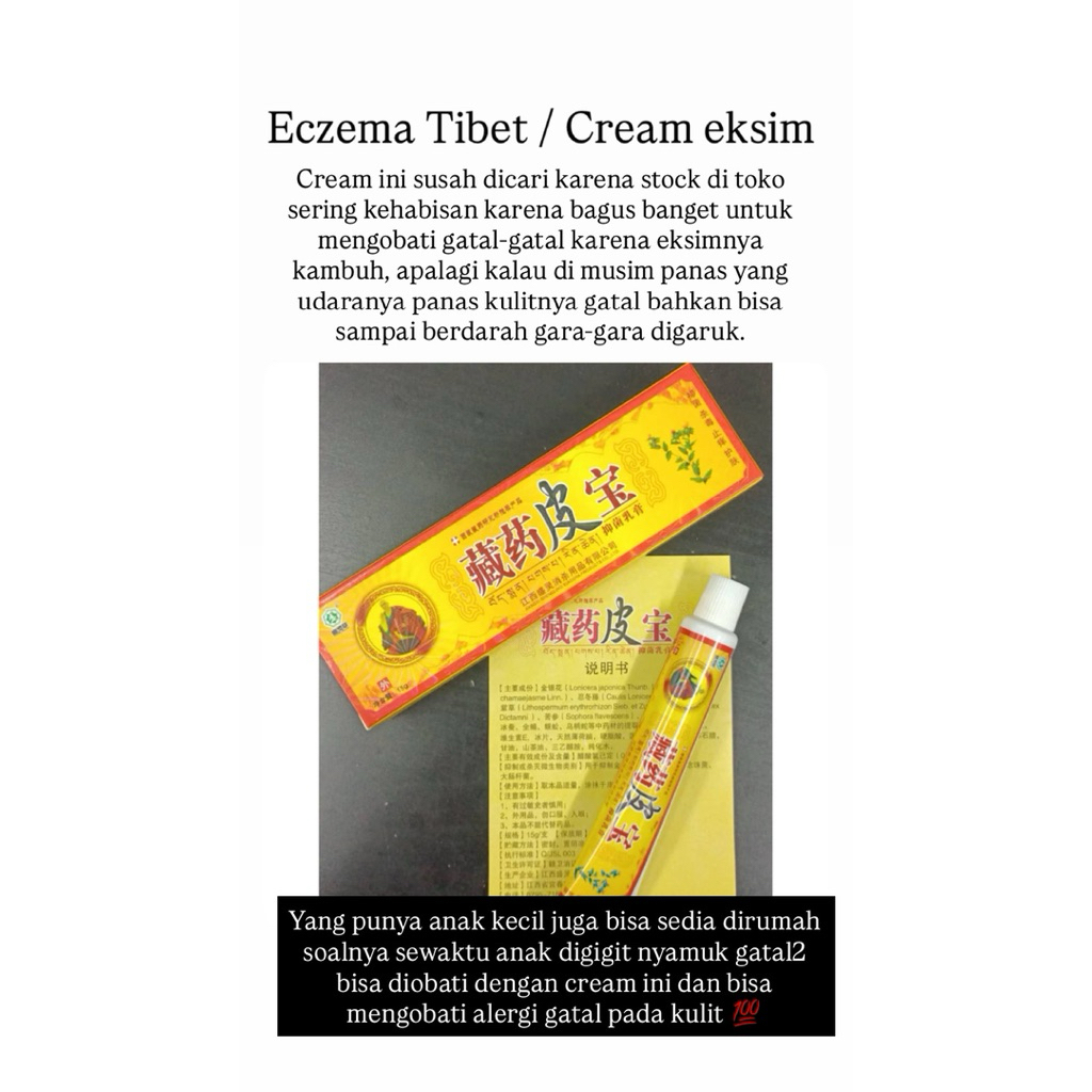 Cream eksim tibet 100% original