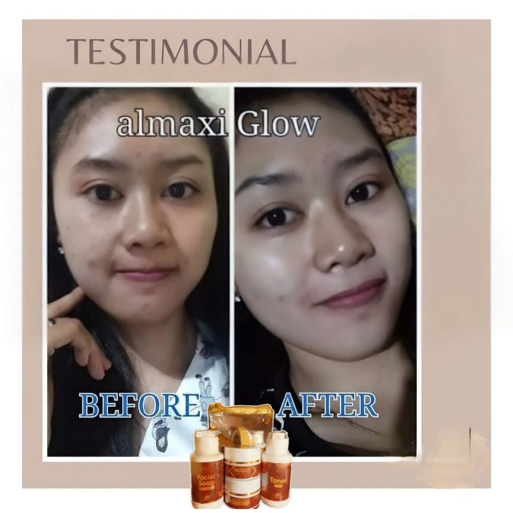 paket whitening almaxiglow
