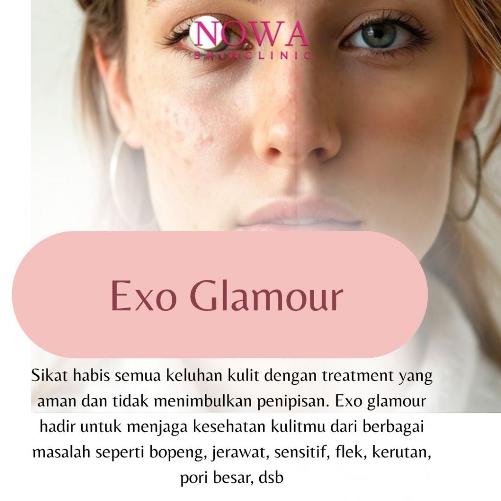 Exo Glamour