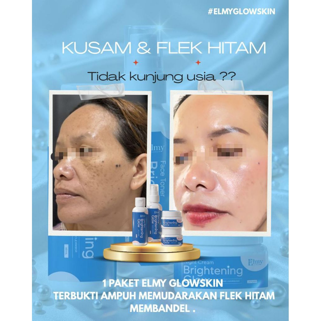 ELMY GLOWSKIN