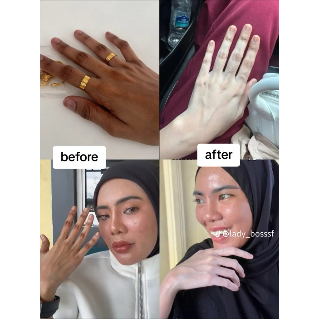 SFBOSTERwhitening 50ml