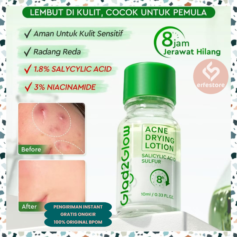 Glad2Glow Acne Drying Lotion 10ml