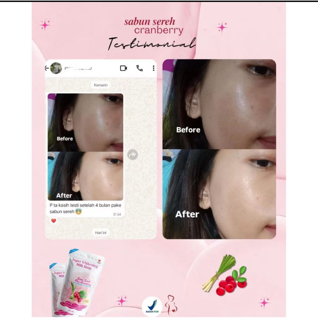 EXPOLIASi KULIT BADAK