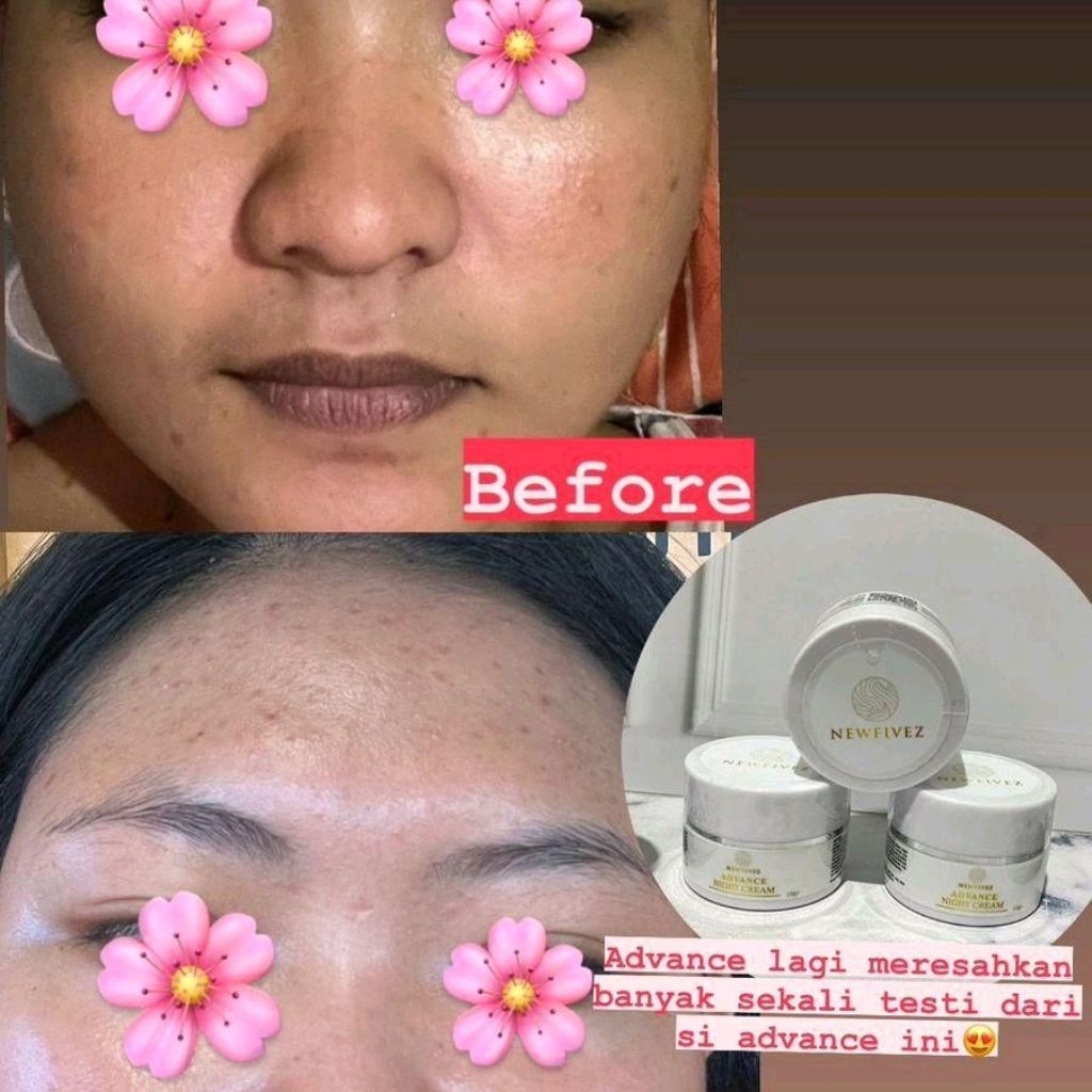 advance night cream