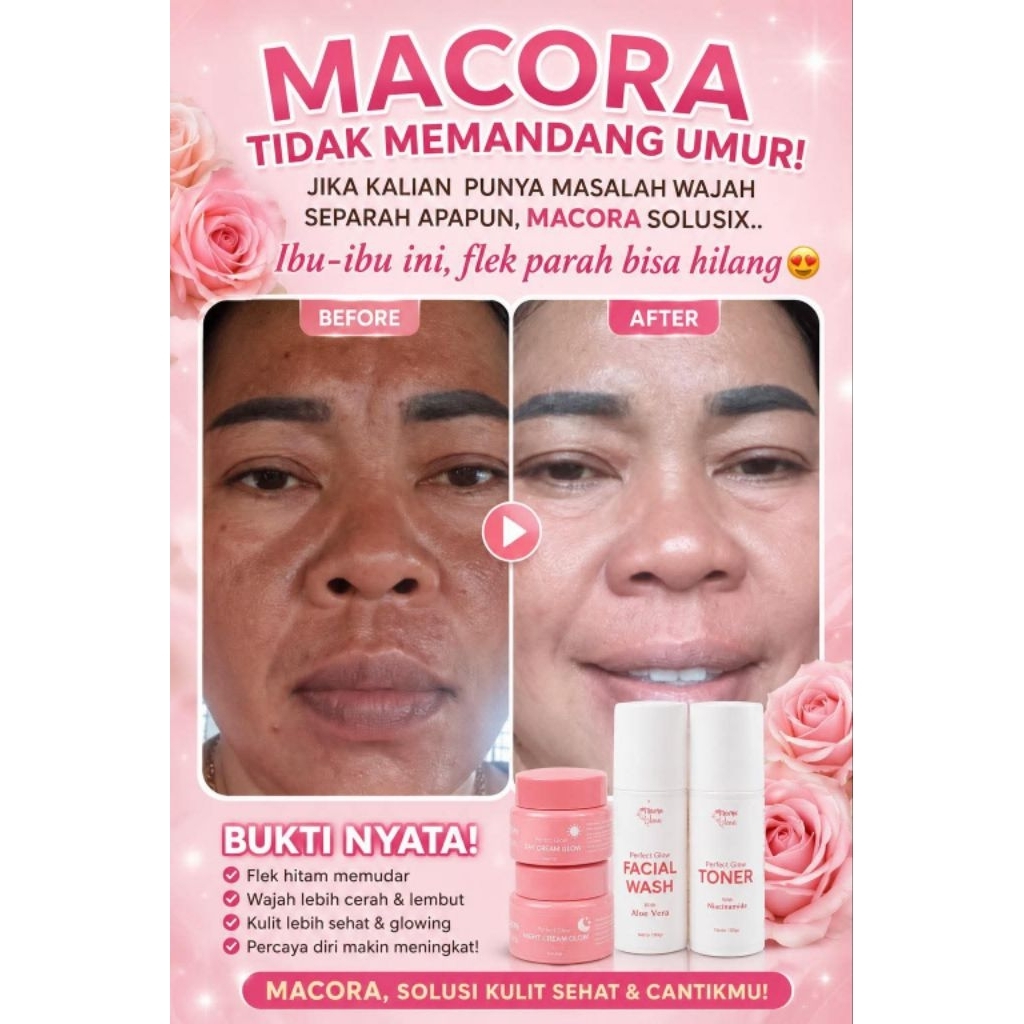 Macora Glow / Normal