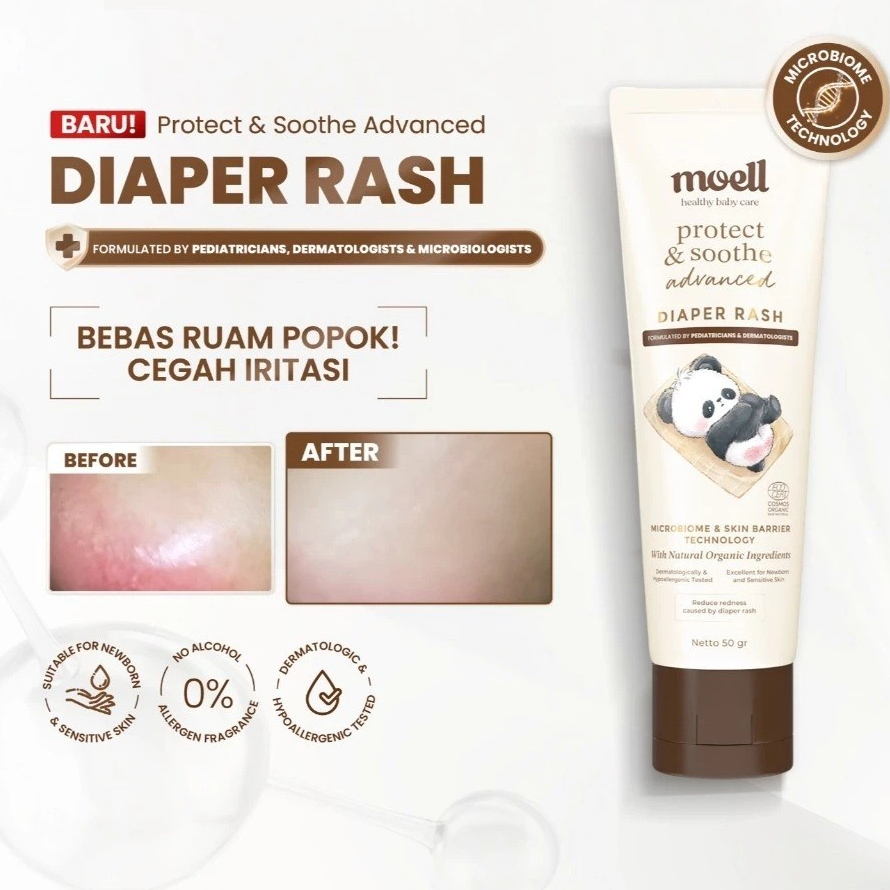 Moell Diaper Rash Advanced 50gr