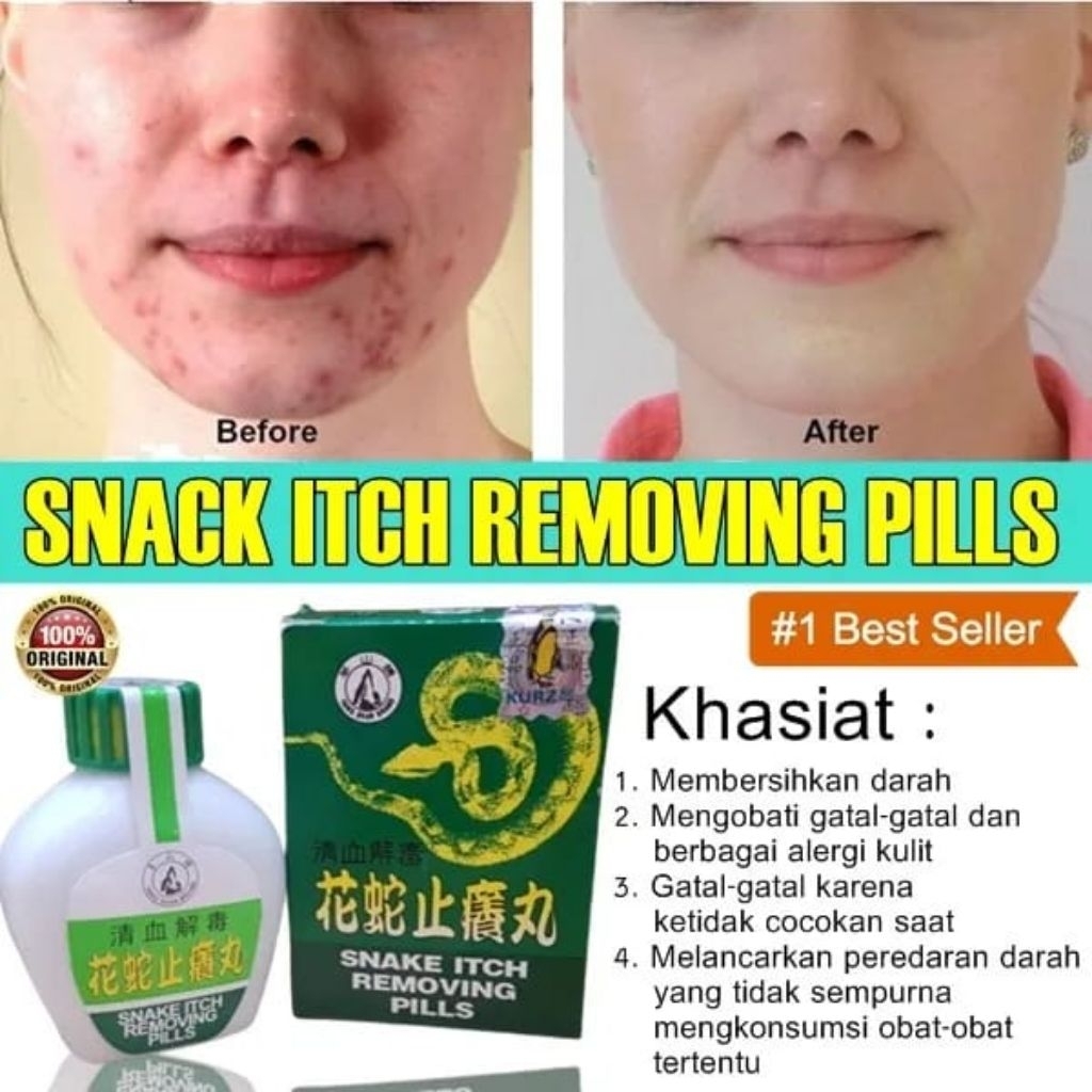 Hua She Gatal-gatal