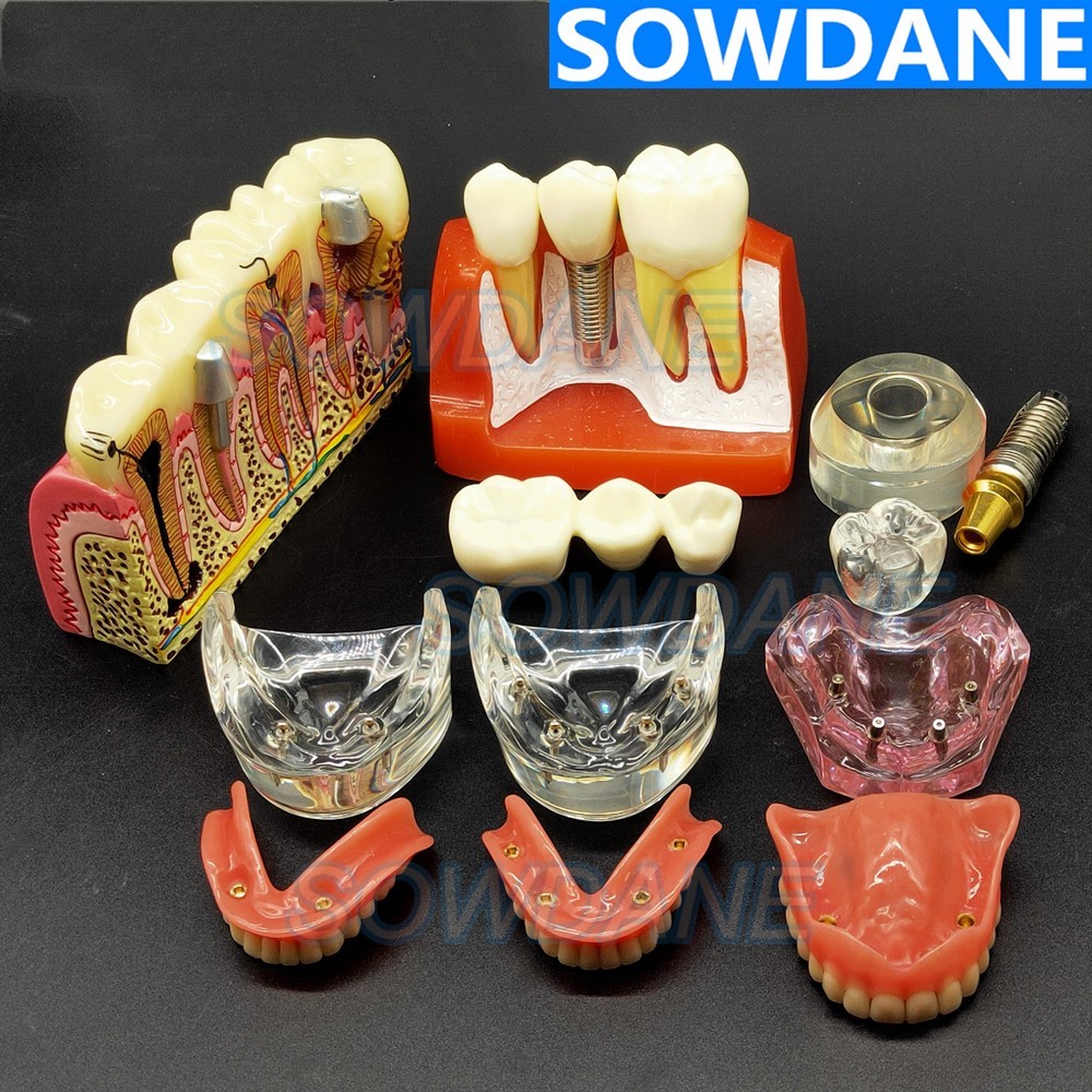 Dental Implant Demonstration Model Teeth Study Teach Model Disease