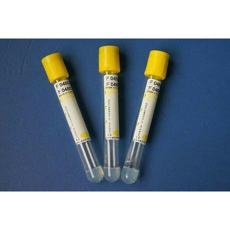 Tabung Vacutainer Warna Kuning