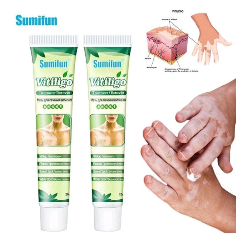 Salep kulit SUMIFUN/Salep kulit VITILIGO