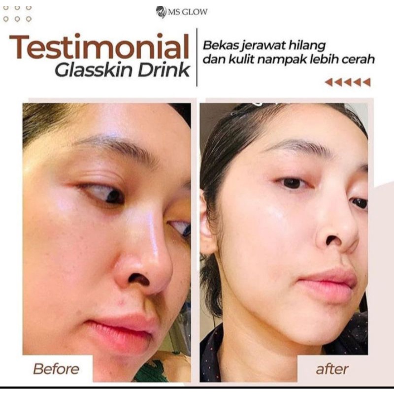glaskin drink ms glow