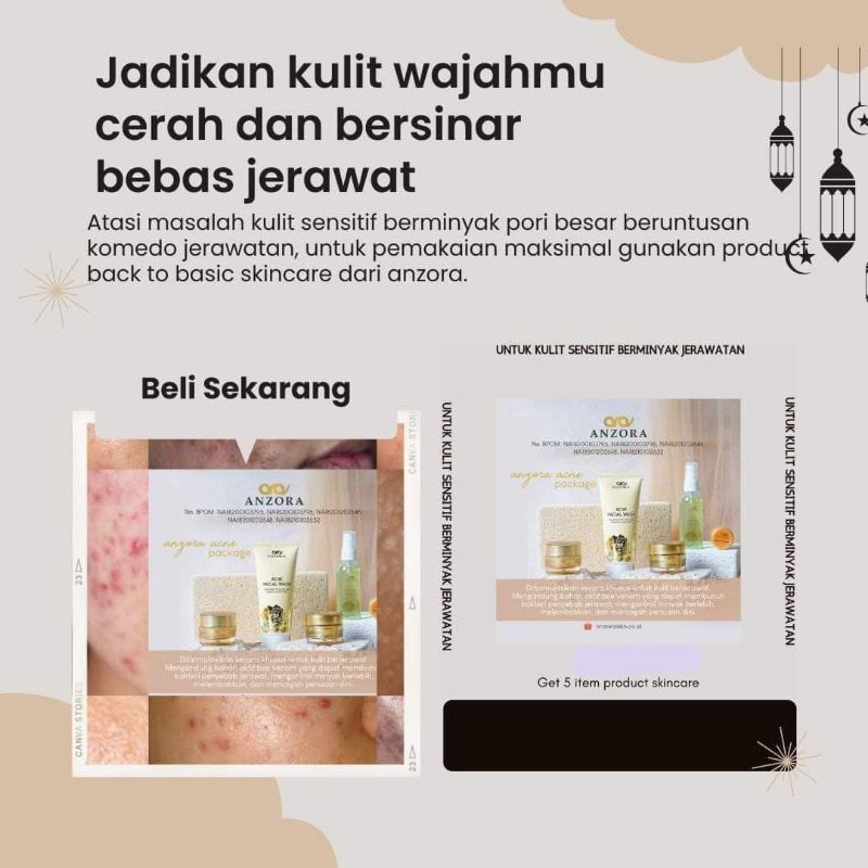 ANZORA ACNE