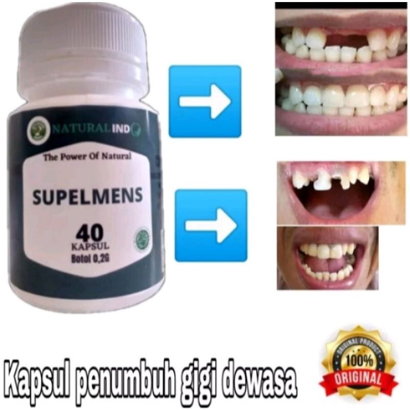SUPLEMEN PENUMBUH GIGI