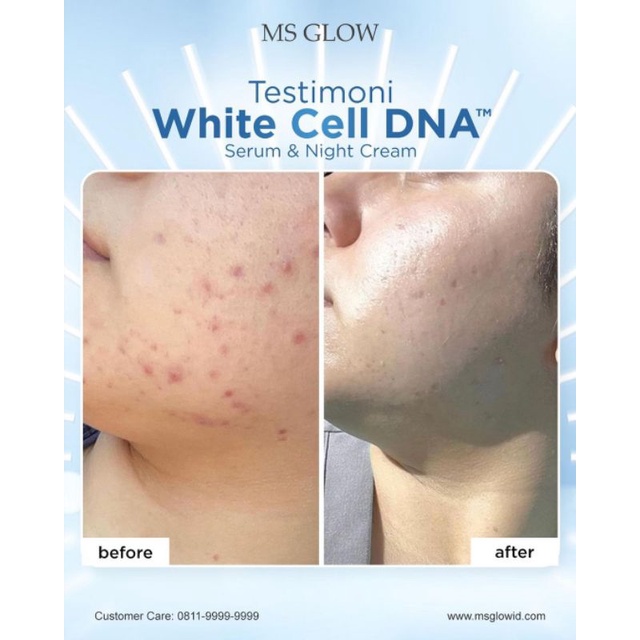 serum white cell dna