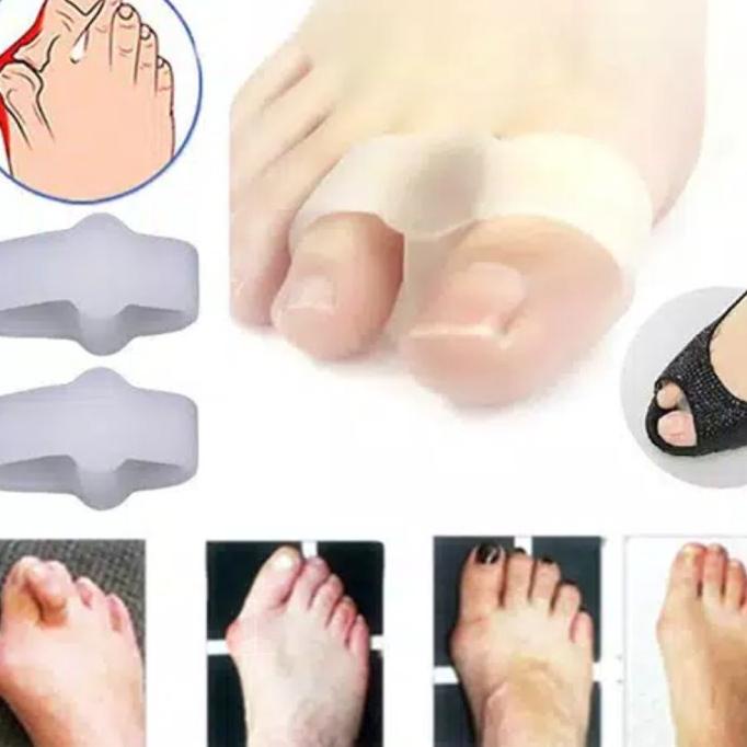 Bunion toe separator gel