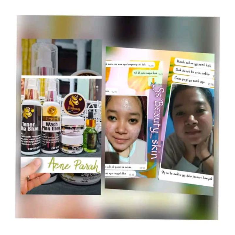 PAKE T ACNE SS BEAUTY