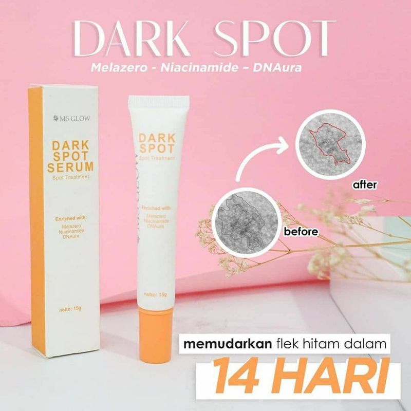 Ms Glow Dark spot Serum